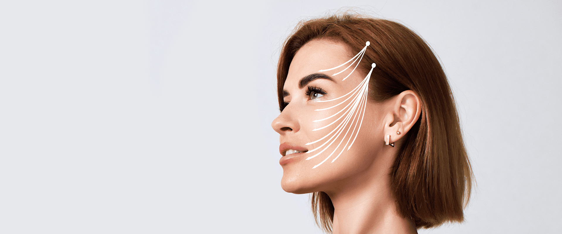 Blefaroplastia