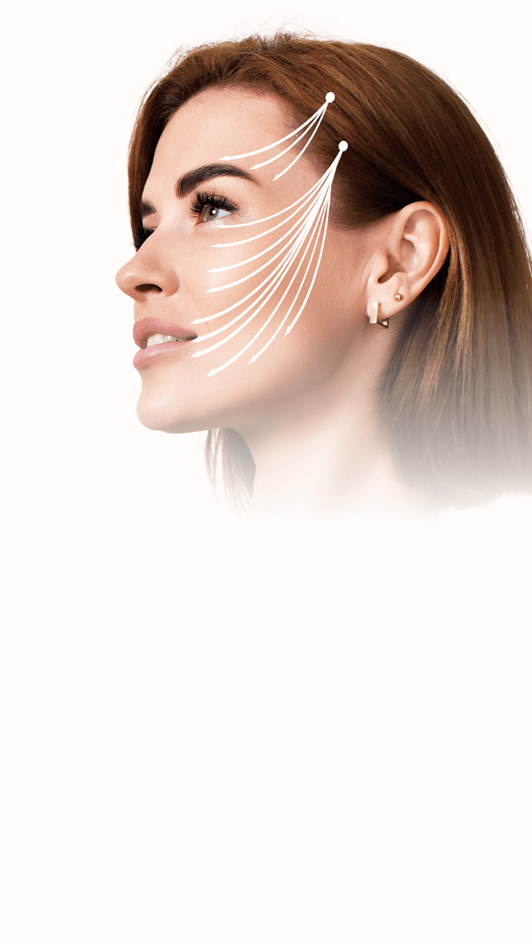 Blefaroplastia
